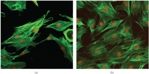 Phalloidin-stained actin filaments of osteoblasts proli | Open-i