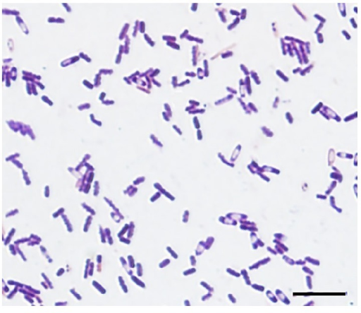 Gram Positive Rods Blood Culture