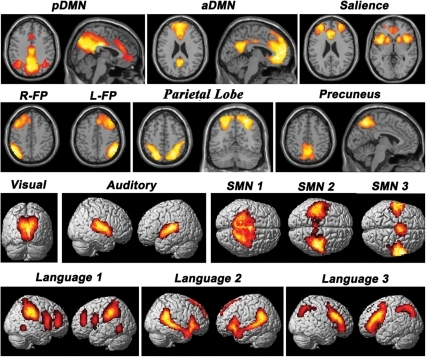 Functionally Relevant Resting-state Networks.This Figur | Open-i