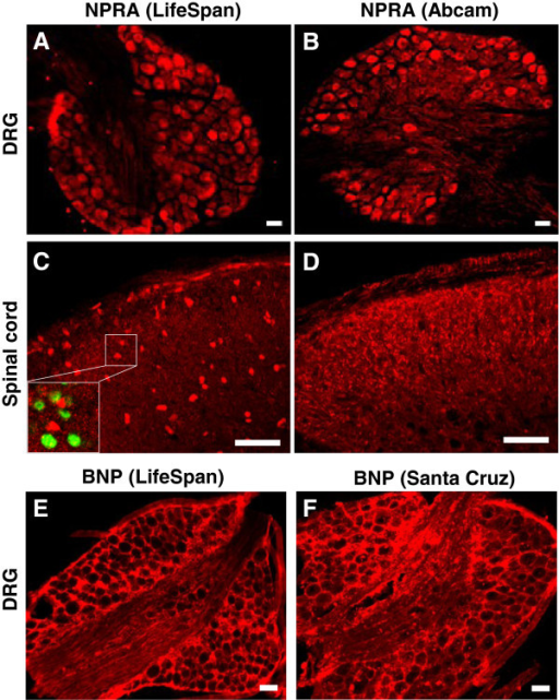 NPRA and BNP immunostaining in DRG neurons and spinal c Open i