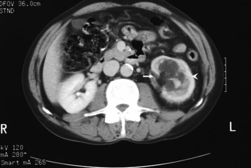 ct urography definition