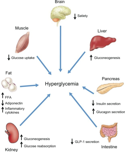 Pathophysiology Of Type 2 Diabetes Mellitus