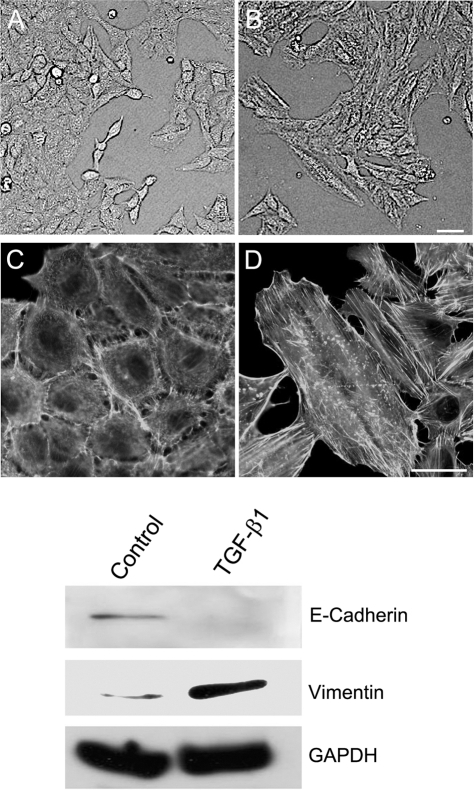 Tgf β Induced Emt A549 Cells Were Cultured In Medium W Open I