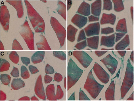 Morphological changes of the skeletal muscle in control rats and COPD model rats that were treated with vehicles, AICAR or resveratrol at week 20 (H &amp; E stained). (A) Control rats; (B) COPD rats with vehicle; (C) COPD rats with AICAR treatment; and (D) COPD rats with resveratrol treatment. Amplification ×200.