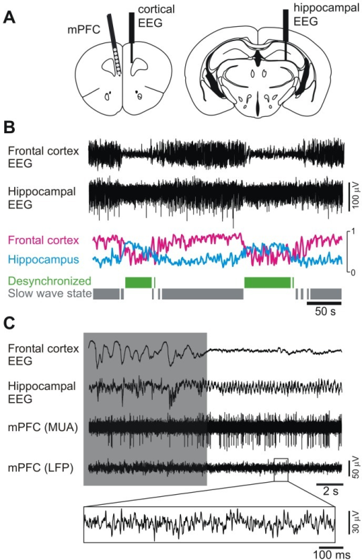 Recording of mPFC activity under different global brain | Open-i