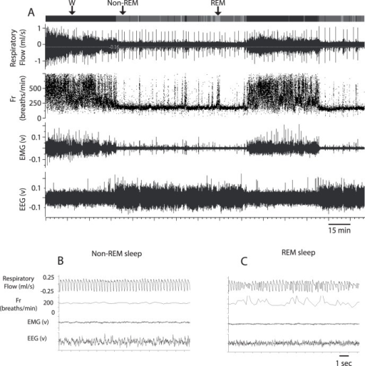 Typical recordings of respiratory flow, instantaneous b | Open-i