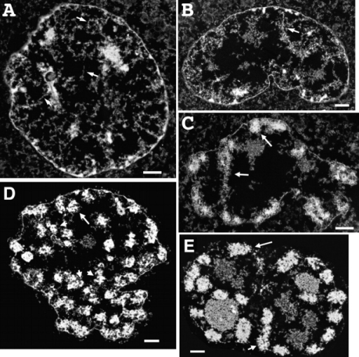 TEM survey of prophase chromosome condensation stages. Biology Diagrams