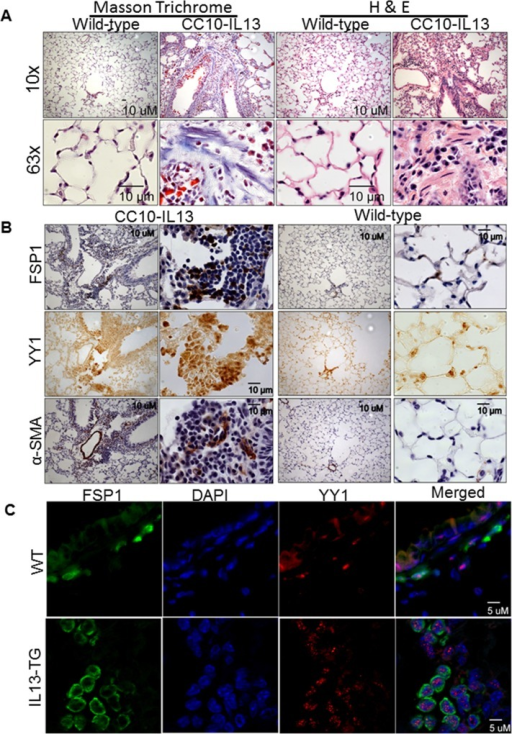 Fibroblast Specific Protein 1 (FSP1), α-SMA, YY1, And | Open-i