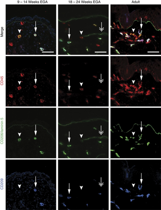 CD45+CD206+CD209+ and CD45+CD206+CD209− cells are pre | Open-i