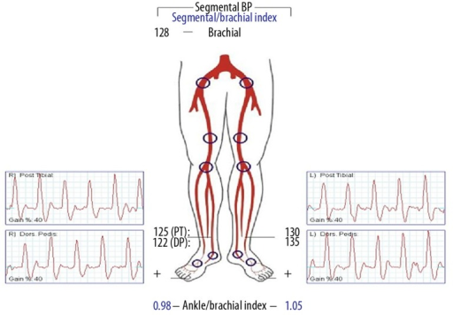 Arterial Doppler exam revealed normal bilateral triphas | Open-i