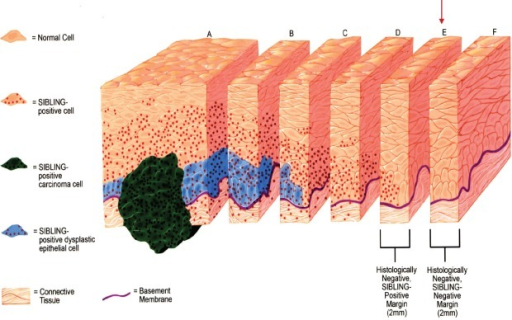 Schematics illustration of Tumor Margin Estimation with | Open-i