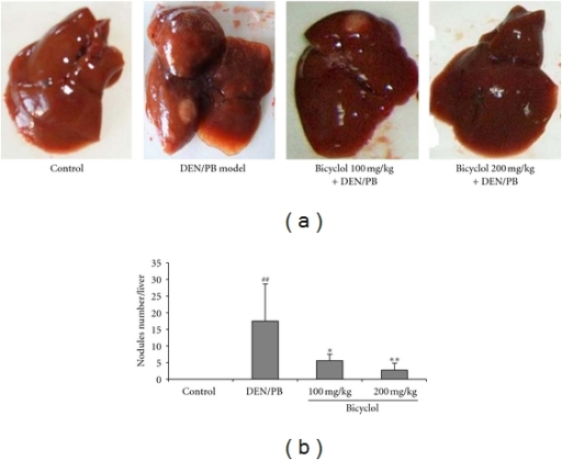 gross-liver-tumor-and-nodule-phenotypes-in-den-pb-induc-open-i