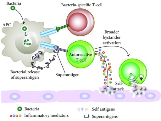 Superantigens and autoimmunity. Infection can lead to t | Open-i