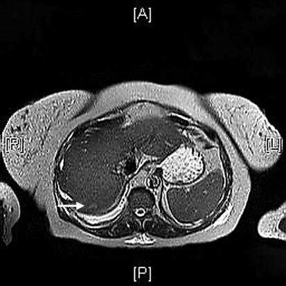 open mri openi liver abdomen policy copyright access normal