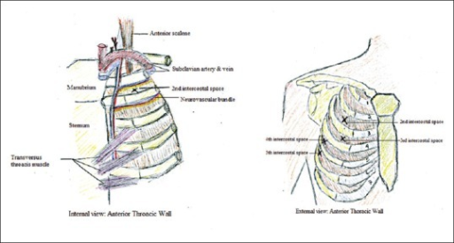 Left Schematic Representation Of The Anatomic Locatio Open I