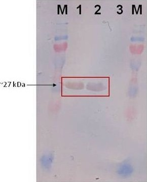 western blot analysis lanes m pageruler plus prest open i page ruler