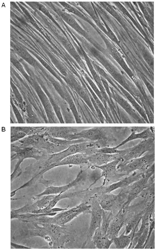 Morphology of isolated normal and tumor-derived fibrobl | Open-i