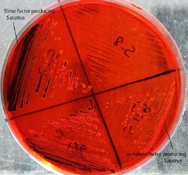 Slime Factor Production of S.aureus on Congo Red Agar. Open i