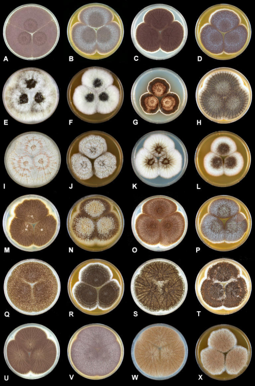 aspergillus fumigatus identification and molecular character Molecular identification: within a flavus complex remains difficult due to overlapping morphological and biochemical characteristics aspergillus fumigatus. aspergillus fumigatus identification and molecular character Molecular identification: within a flavus complex remains difficult due to overlapping morphological and biochemical characteristics aspergillus fumigatus.