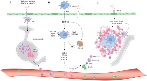 A schematic model for granuloma formation in pulmonary | Open-i