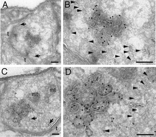 Cryoimmuno-EM of the GFP-2xFYVE endosome. (A–D) Cryoi | Open-i