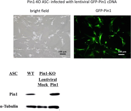 Pin1 KO ASC transfected with Lentiviral Pin1 cDNA.Tran Open i