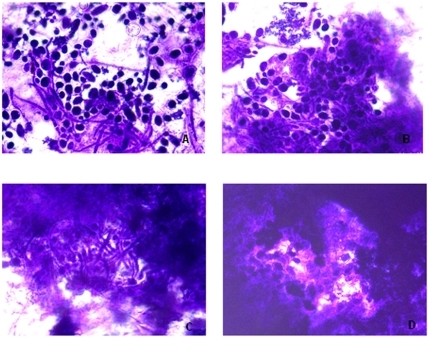 inverted microscope images of c albicans biofilms form open i