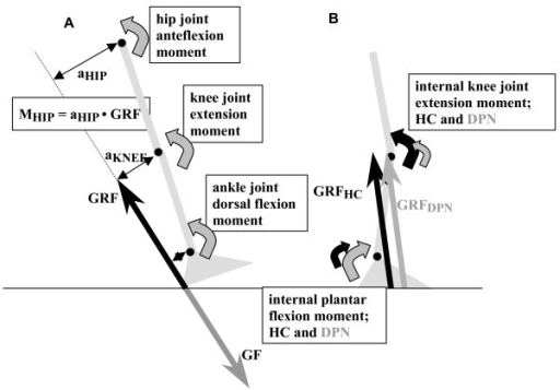 a: A theoretical scheme of the foot, the lower leg and | Open-i