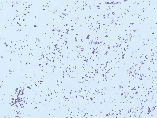 Weissella confusa Gram stain morphology from a sheep bl | Open-i