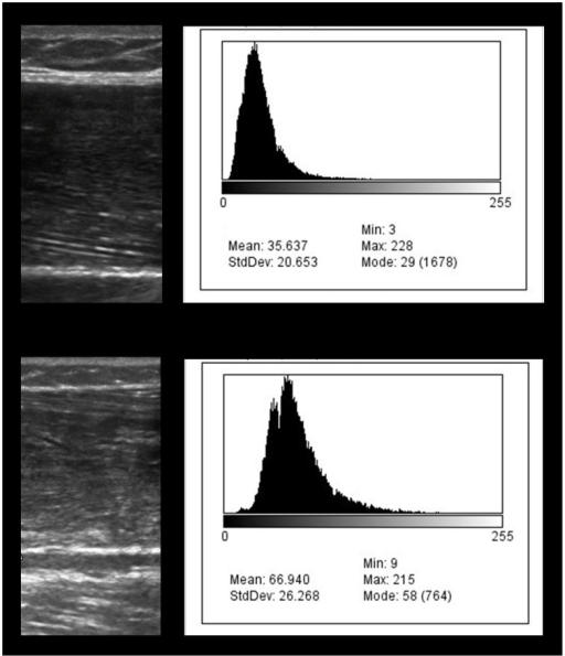 histogram ultrasound ultrasound rectus image regio Diagnostic the femoris of