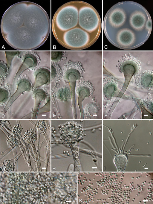 aspergillus fumigatus identification and molecular character Molecular identification: within a flavus complex remains difficult due to overlapping morphological and biochemical characteristics aspergillus fumigatus. aspergillus fumigatus identification and molecular character Molecular identification: within a flavus complex remains difficult due to overlapping morphological and biochemical characteristics aspergillus fumigatus.