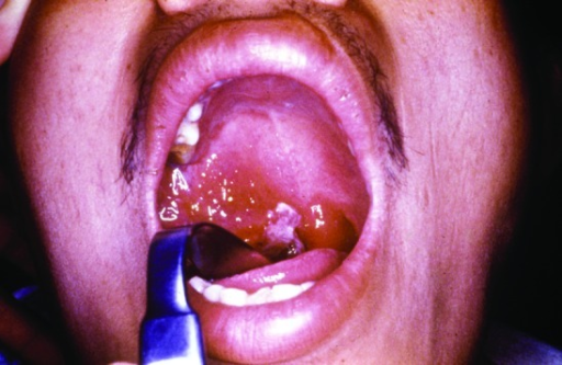 A 27-year-old man, 5 days after the onset of symptoms o ...