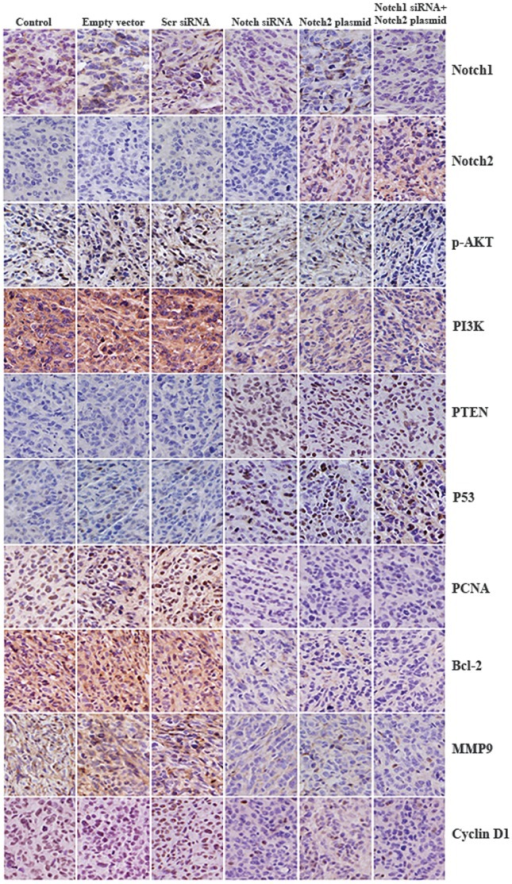 Expression of EGFR/PI3K/AKT pathway relative genes in x | Open-i