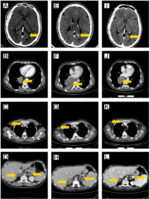 body scans and bottleneck case And he says to me on a monday morning, “did you hear about the wonderful case we had” so i said, “well, i'm sure i. body scans and bottleneck case And he says to me on a monday morning, “did you hear about the wonderful case we had” so i said, “well, i'm sure i.