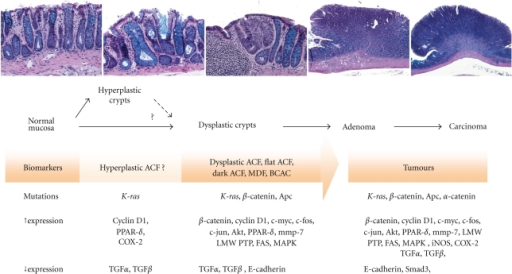 histopathological alterations in human colon