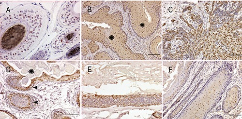 Sox9 immunohistochemistry. A) Hair follicle positive co 