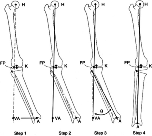 Method of planning the magnitude of the opening wedge [ | Open-i