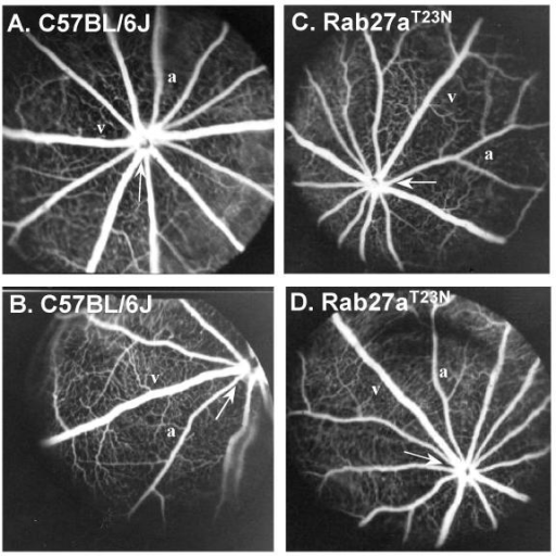 Fluorescein Fundus Angiograms Of Rab27aT23N Transgenic Mouse Retina Six Monthsold Wild Type Fluorescein Fundus Angiograms Of Rab27aT23N Transgenic Mouse Retina Six Monthsold Wild Type
