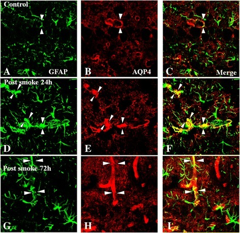 Immunoexpression of AQP4 (red) and GFAP (green) in the | Open-i