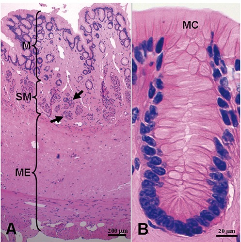 Histology of the esophagus. Panel B shows detail of epi | Open-i