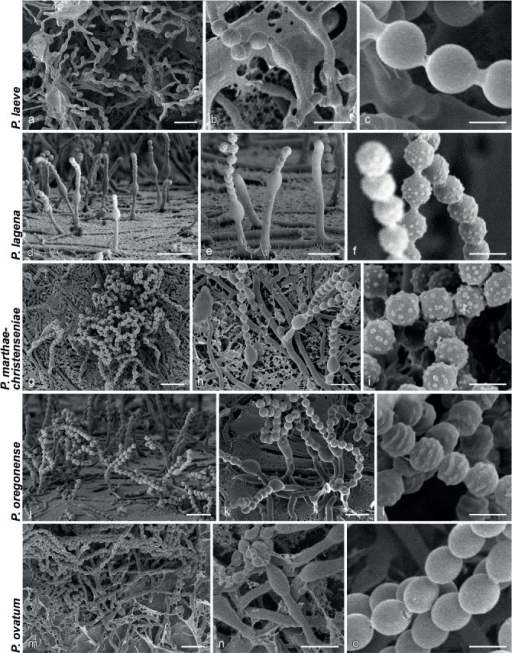 Sem Micrographs Showing Characters Of Monophialidic Pen Open I