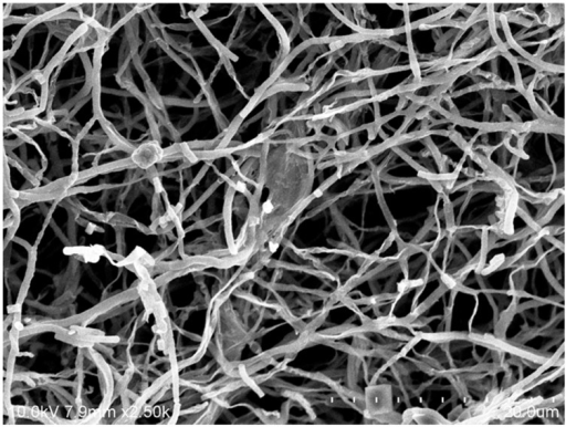 Scanning electron microscope of Streptomyces mangroviso | Open-i