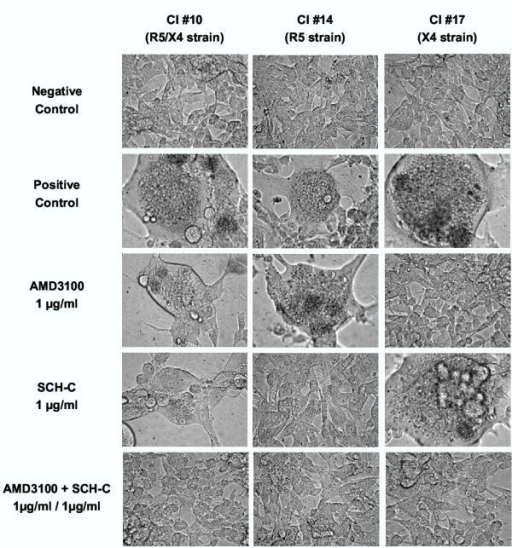 Microscopic view of cytopathic effect (giant cell forma | Open-i