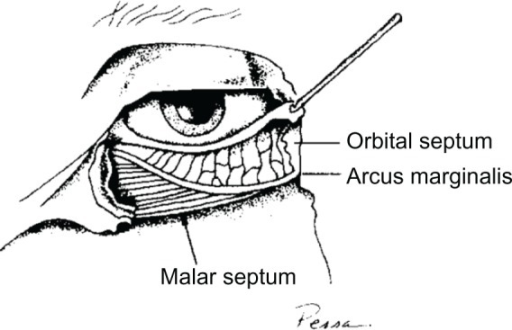 The anatomic basis of malar edema.Notes: Pessa JE, Garz | Open-i