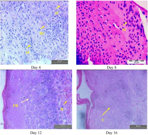 Hematoxylin And Eosin Hande Staining Of Control And Contracted Breast