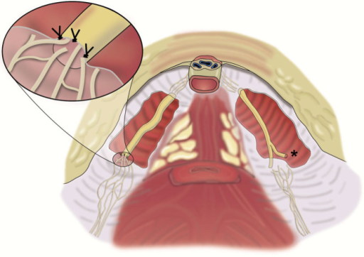 Viagra after radical prostatectomy