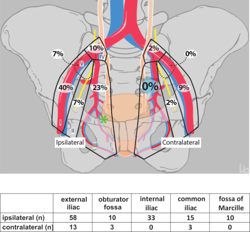Schematic Diagram Showing The Distribution Of Lymph Nod Open I