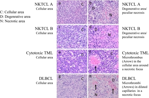 Cellular, degenerative and necrotic areas in lymphoma t 