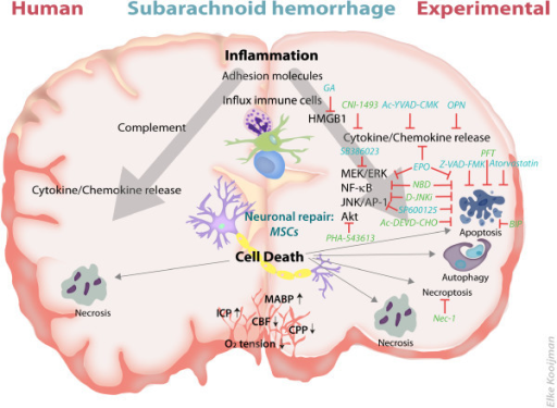 Therapeutic targets and mechanisms of brain damage in h | Open-i