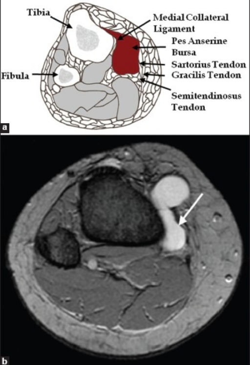 (a) Axial Line Diagram And (b) Axial Magnetic Resonance | Open-i